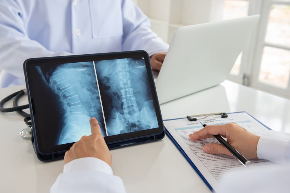 medical professional looking over spine x-ray with patient