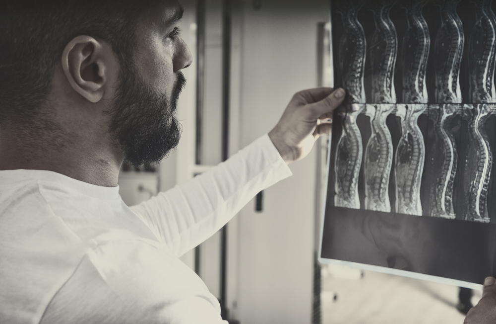 Spinal Cord Injury