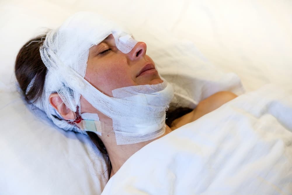 A woman with facial and head bandages is lying in a hospital bed, appearing to be asleep or unconscious.